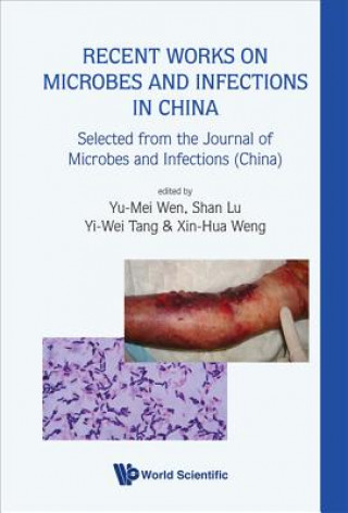 Книга Recent Works On Microbes And Infections In China: Selected From The Journal Of Microbes And Infections (China) Yu-Mei Wen