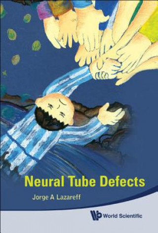 Kniha Neural Tube Defects Jorge A. Lazareff