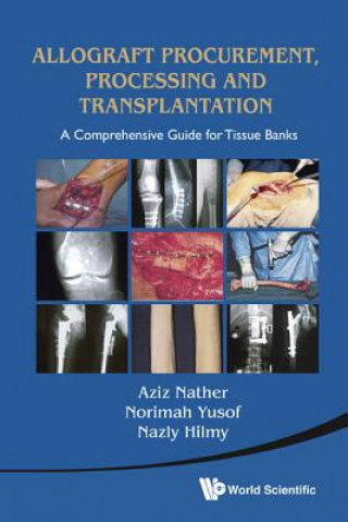 Kniha Allograft Procurement, Processing And Transplantation: A Comprehensive Guide For Tissue Banks Aziz Nather