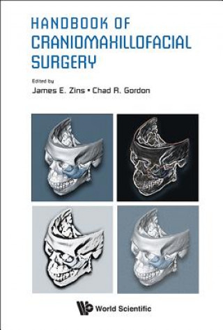 Kniha Handbook Of Craniomaxillofacial Surgery Chad R Gordon