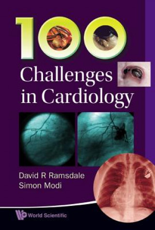 Książka 100 Challenges In Cardiology David R. Ramsdale