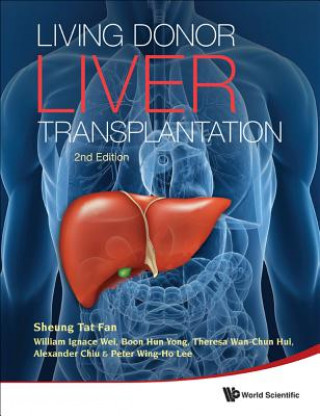 Könyv Living Donor Liver Transplantation Sheung Tat Fan