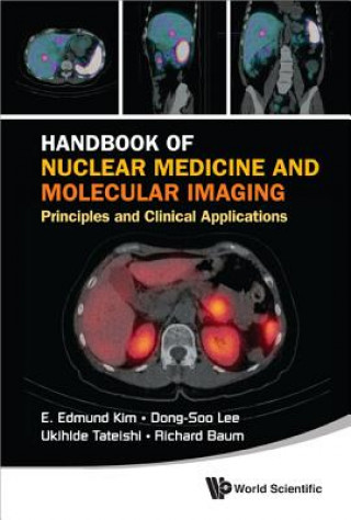 Carte Handbook Of Nuclear Medicine And Molecular Imaging: Principles And Clinical Applications E. Edmund Kim