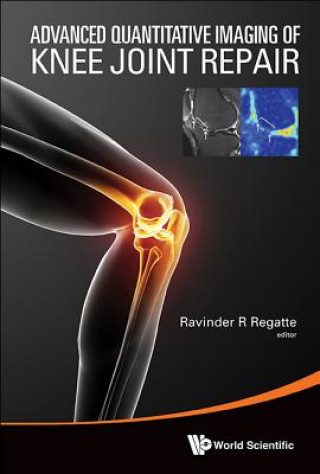 Buch Advanced Quantitative Imaging Of Knee Joint Repair Ravinder R Regatte