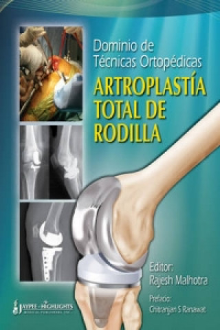 Kniha Dominio de Tecnicas Ortopedicas: Artroplastia Total de Rodilla Rajesh Malhotra