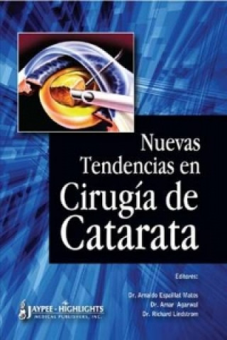 Kniha Nuevas Tendencias en Cirugia de Catarata Arnaldo Espaillat Matos