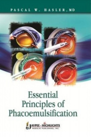 Libro Essential Principles of Phacoemulsification Pascal W. Hasler