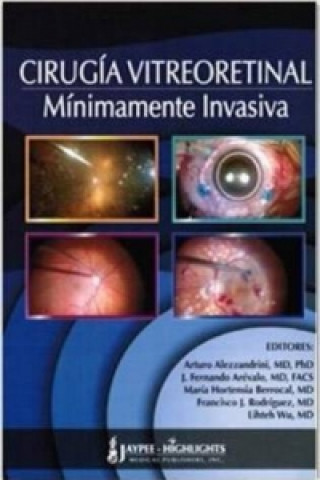 Книга Cirugia Vitreoretinal Minimamente Invasiva 