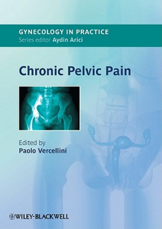 Kniha Chronic Pelvic Pain Paolo Vercellini