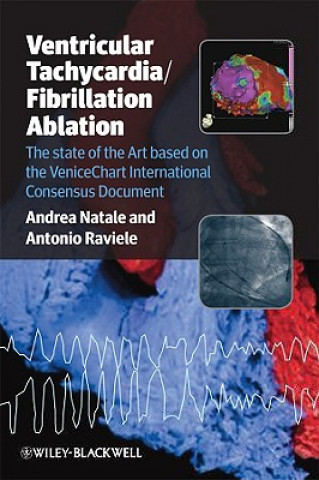 Book Ventricular Tachycardia / Fibrillation Ablation - The State of the Art based on the Venicechart International Consensus Document Antonio Raviele