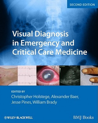 Carte Visual Diagnosis in Emergency and Critical Care Medicine 2e Christopher P. Holstege