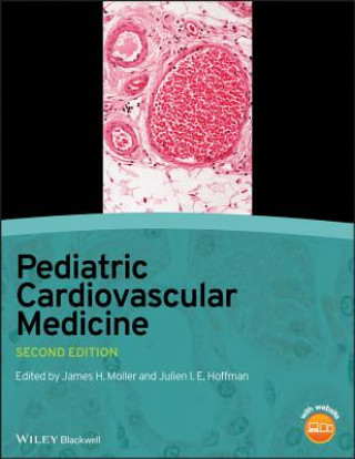 Kniha Pediatric Cardiovascular Medicine 2e James H. Moller