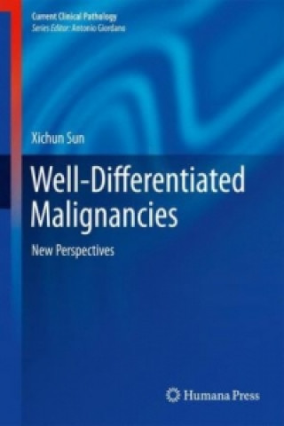 Carte Well-Differentiated Malignancies, 1 Xichun Sun