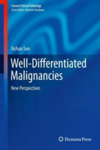 Книга Well-Differentiated Malignancies, 1 Xichun Sun