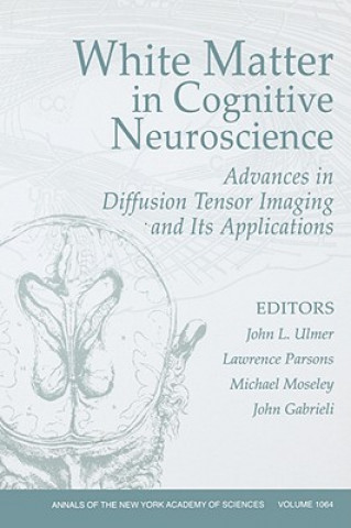 Carte White Matter in Cognitive Neuroscience: Advances in Diffusion Tensor Imaging and Its Applications Ulmer