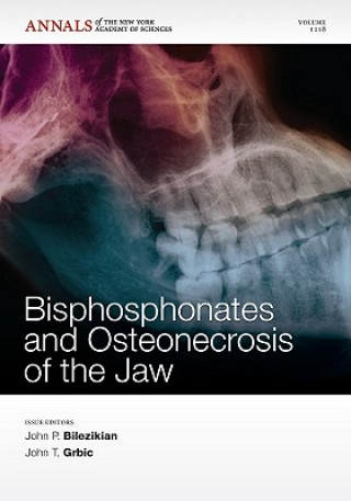 Książka Bisphosphonates and Osteonecrosis of the Jaw John P. Bilezikian