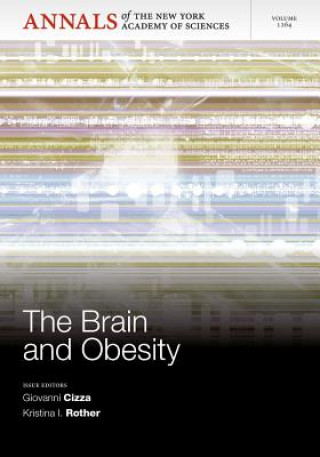 Carte Brain and Obesity Giovanni Cizza