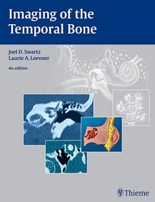 Kniha Imaging of the Temporal Bone Laurie A. Loevner