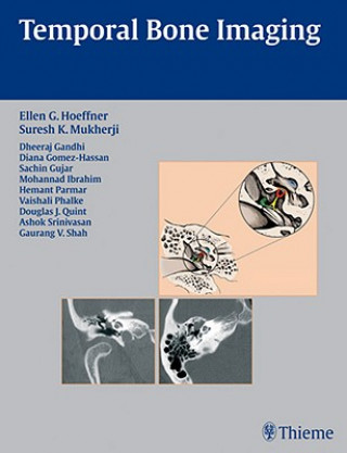 Książka Temporal Bone Imaging Ellen G. Hoeffner