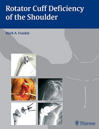 Książka Rotator Cuff Deficiency of the Shoulder Mark A. Frankle