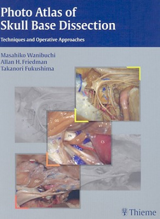 Carte Photo Atlas of Skull Base Dissection Allan H. Friedman