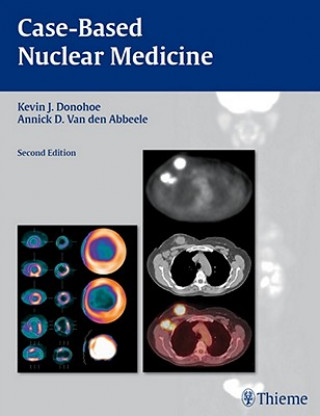 Книга Case-Based Nuclear Medicine Kevin J. Donohoe