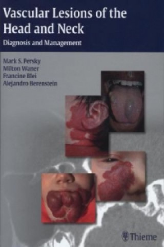 Buch Vascular Lesions of the Head and Neck Mark S. Persky