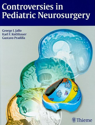Kniha Controversies in Pediatric Neurosurgery George I. Jallo