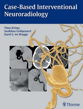 Kniha Case-Based Interventional Neuroradiology Timo Krings