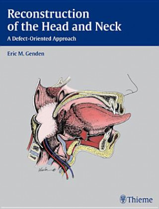 Knjiga Reconstruction of the Head and Neck Eric M. Genden