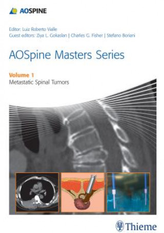 Carte AOSpine Masters Series Volume 1: Metastatic Spinal Tumors Luiz Roberto Gomes Vialle