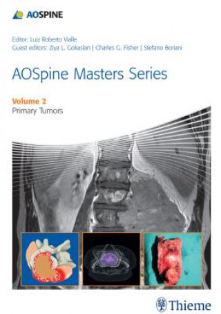 Book AOSpine Masters Series Volume 2: Primary Spinal Tumors Luiz Roberto Gomes Vialle