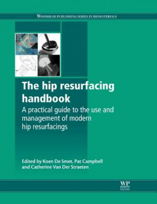 Carte Hip Resurfacing Handbook K De Smet