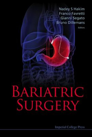 Kniha Bariatric Surgery Franco Favretti
