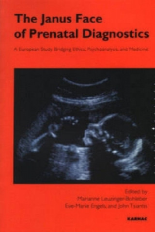 Knjiga Janus Face of Prenatal Diagnostics Eve-Marie Engels