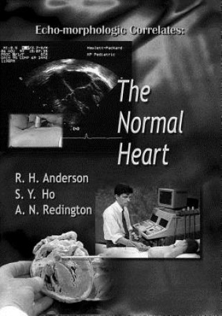 Könyv Echo-morphologic Correlates: The Normal Heart (With Video) S.Y. Ho