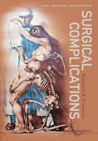 Buch Surgical Complications: Diagnosis And Treatment Nadey S. Hakim