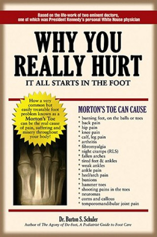 Könyv Why You Really Hurt Burton S Schuler