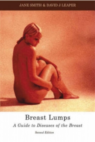 Könyv Breast Lumps Jane Smith