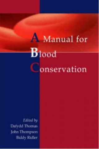 Kniha manual for blood conservation D Thomas