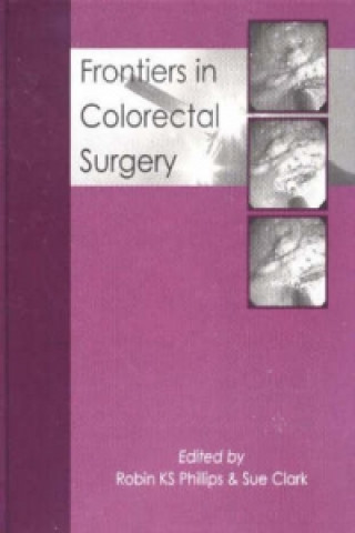 Könyv Frontiers in Colorectal Surgery Robin K S Phillips