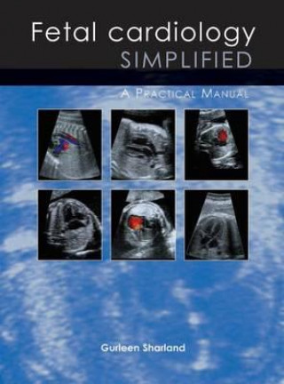 Knjiga Fetal Cardiology Simplified Gurleen Sharland