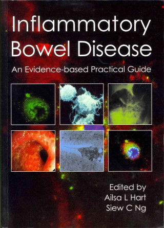 Книга Inflammatory Bowel Disease Alisa L Hart