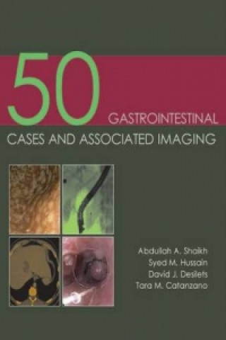 Könyv 50 Gastrointestinal Cases and Associated Imaging Abdullah A Shaikh