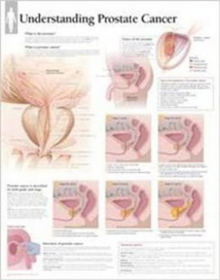 Carte Understanding Prostate Cancer Laminated Poster Scientific Publishing