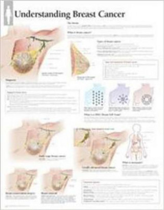 Kniha Understanding Breast Cancer Laminated Poster Scientific Publishing