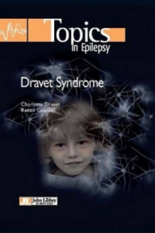 Kniha Dravet Syndrome Charlotte Dravet