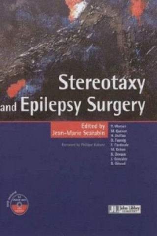 Knjiga Stereotaxy & Epilepsy Surgery Jean-Marie Scarabin