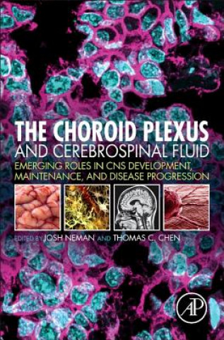 Carte Choroid Plexus and Cerebrospinal Fluid Josh Neman