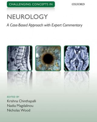 Carte Challenging Concepts in Neurology Chinthapalli